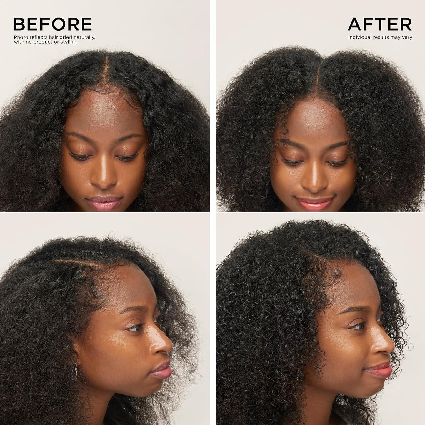 Scalp Serum - Precision Roll-On Formula For Fuller-Looking Hair