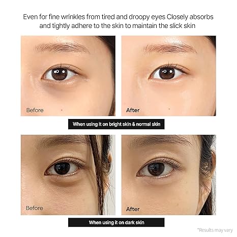 Advanced Calcium Eye Cream for Ultimate Dark Spot & Circle Correction