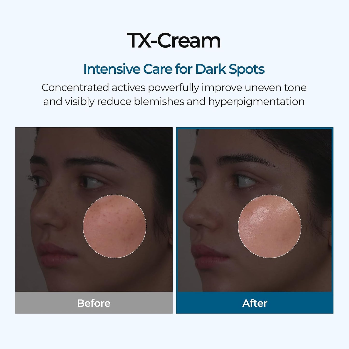 Dark Spot Cream - Tranexamic Acid + Niacinamide Formula For A More Even-Looking Glow