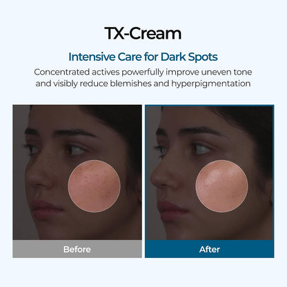 Dark Spot Cream - Tranexamic Acid + Niacinamide Formula For A More Even-Looking Glow