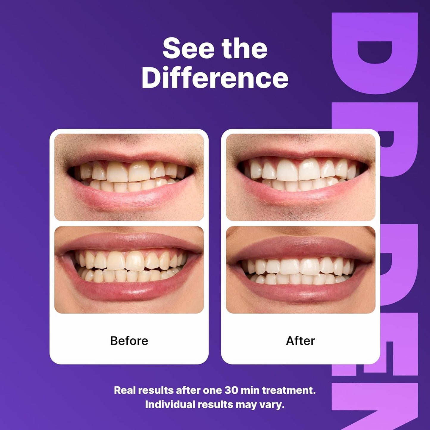 Cancel Yellow Stains Instantly with Purple Color-Correcting Tech