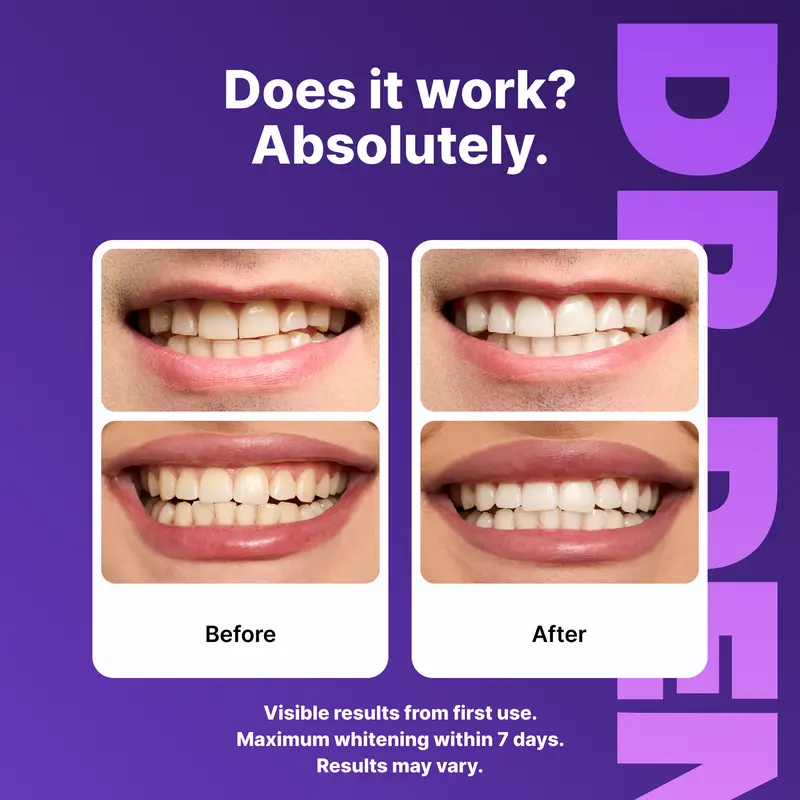 Cancel Yellow Tones Instantly — The Secret To A Brighter, Whiter Smile