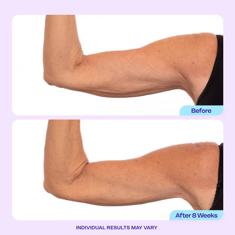 Arm Firming Cream - 7% ProTight Complex For Smoother, Firmer-Looking Arms