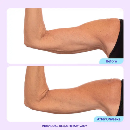 Arm Firming Cream - 7% ProTight Complex For Smoother, Firmer-Looking Arms