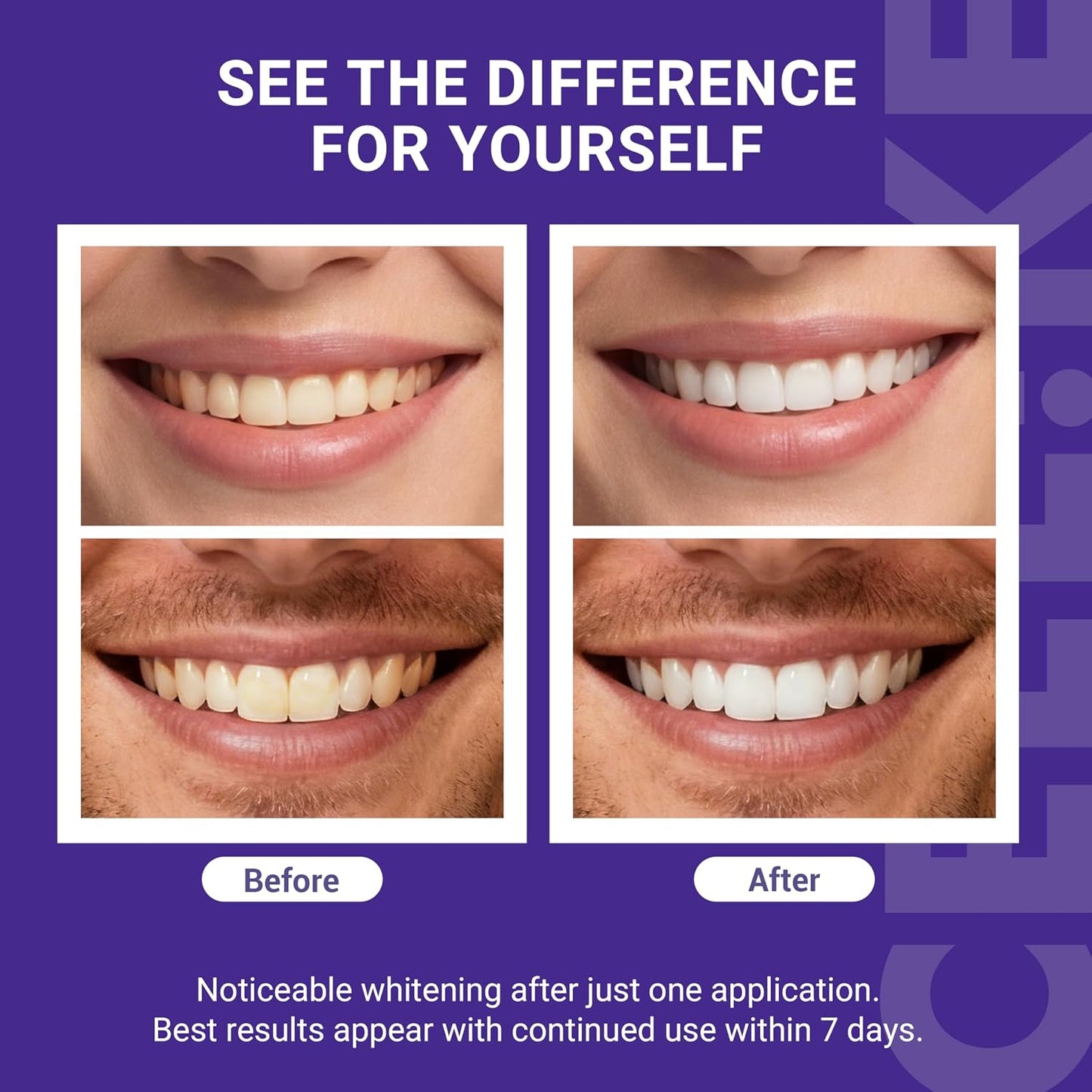 Teeth Whitening Strips - Peroxide-Free Formula For A Brighter Smile