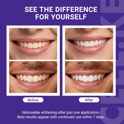 Teeth Whitening Strips - Peroxide-Free Formula For A Brighter Smile