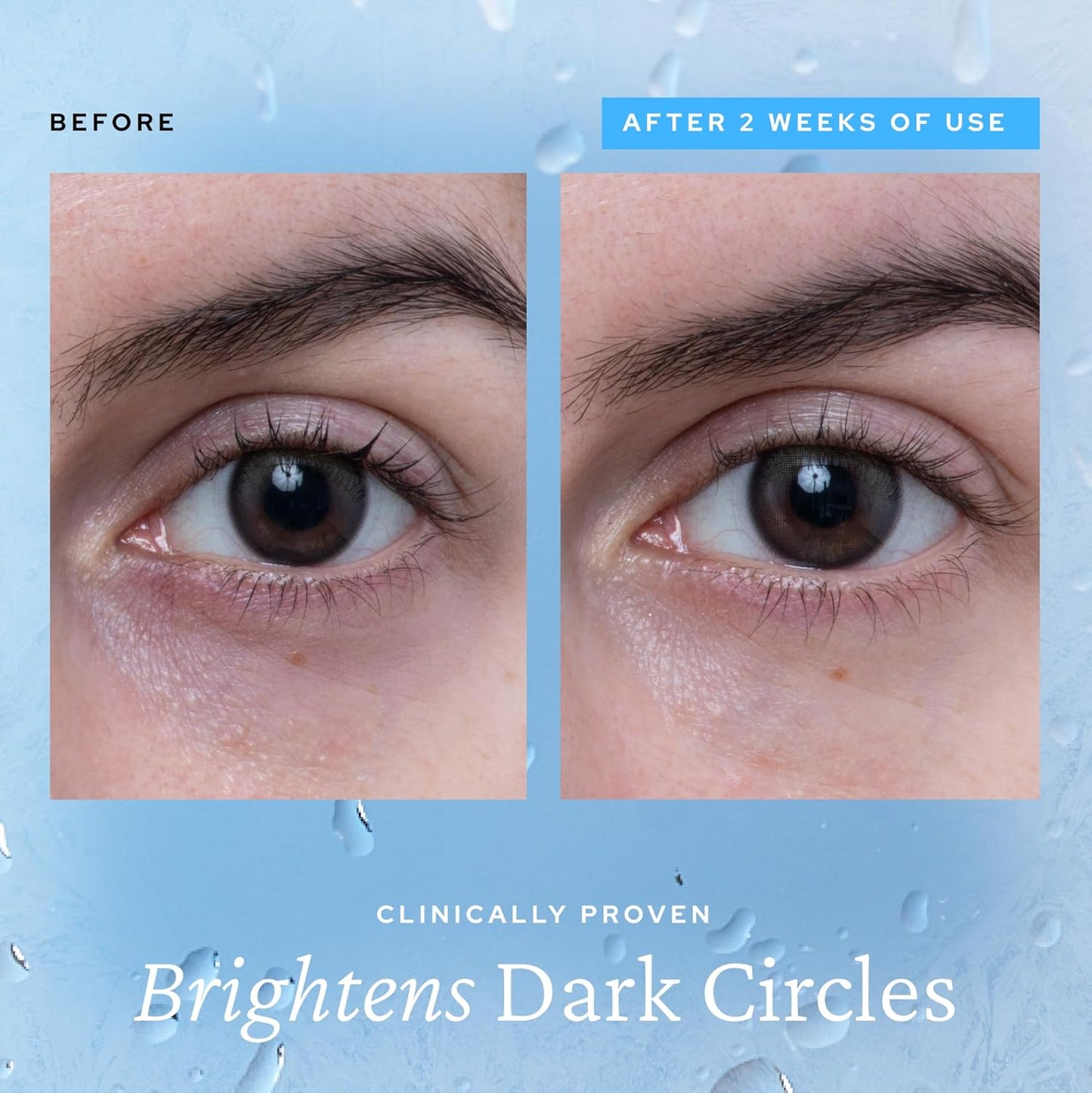 Wake Up Tired Eyes Instantly