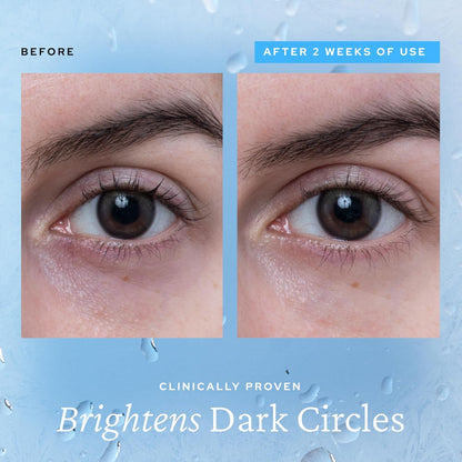Wake Up Tired Eyes Instantly