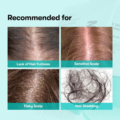 Hair Serum - PDRN Reedle Shot Scalp Care Formula For Fuller-Looking Hair