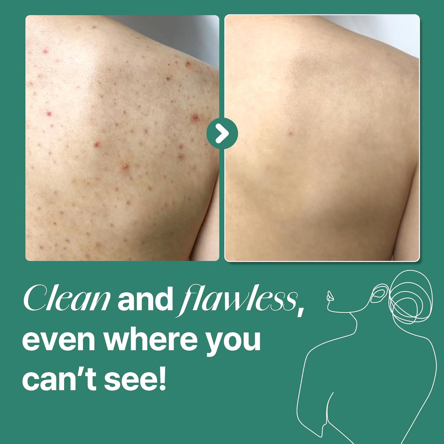 Clearer Skin Starts In The Shower