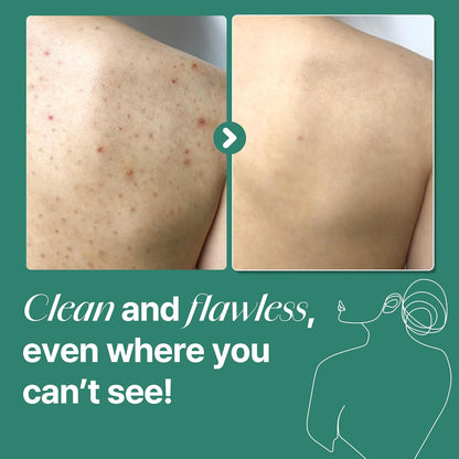 Clearer Skin Starts In The Shower