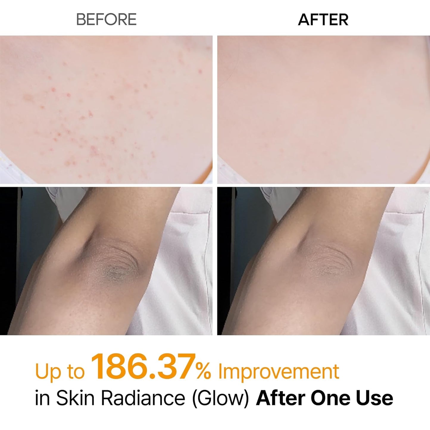 Body Peel Spray - Kojic Acid + Turmeric Formula For Smooth-Looking Skin