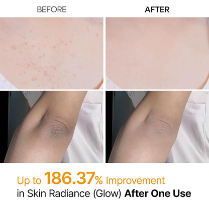 Body Peel Spray - Kojic Acid + Turmeric Formula For Smooth-Looking Skin