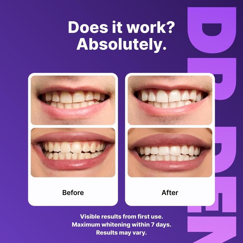 Purple Teeth Whitening Strips | Peroxide-Free & Non-Sensitive | 7-21 Sessions for Enamel Safe Brightening