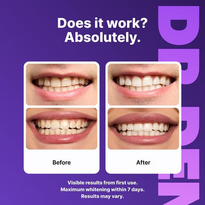 Purple Teeth Whitening Strips | Peroxide-Free & Non-Sensitive | 7-21 Sessions for Enamel Safe Brightening