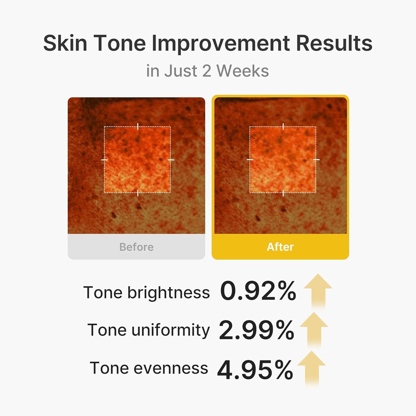 Capsule Brightening Cream - Kojic Acid & Turmeric Gel Capsules For Radiant-Looking Even Skin Tone