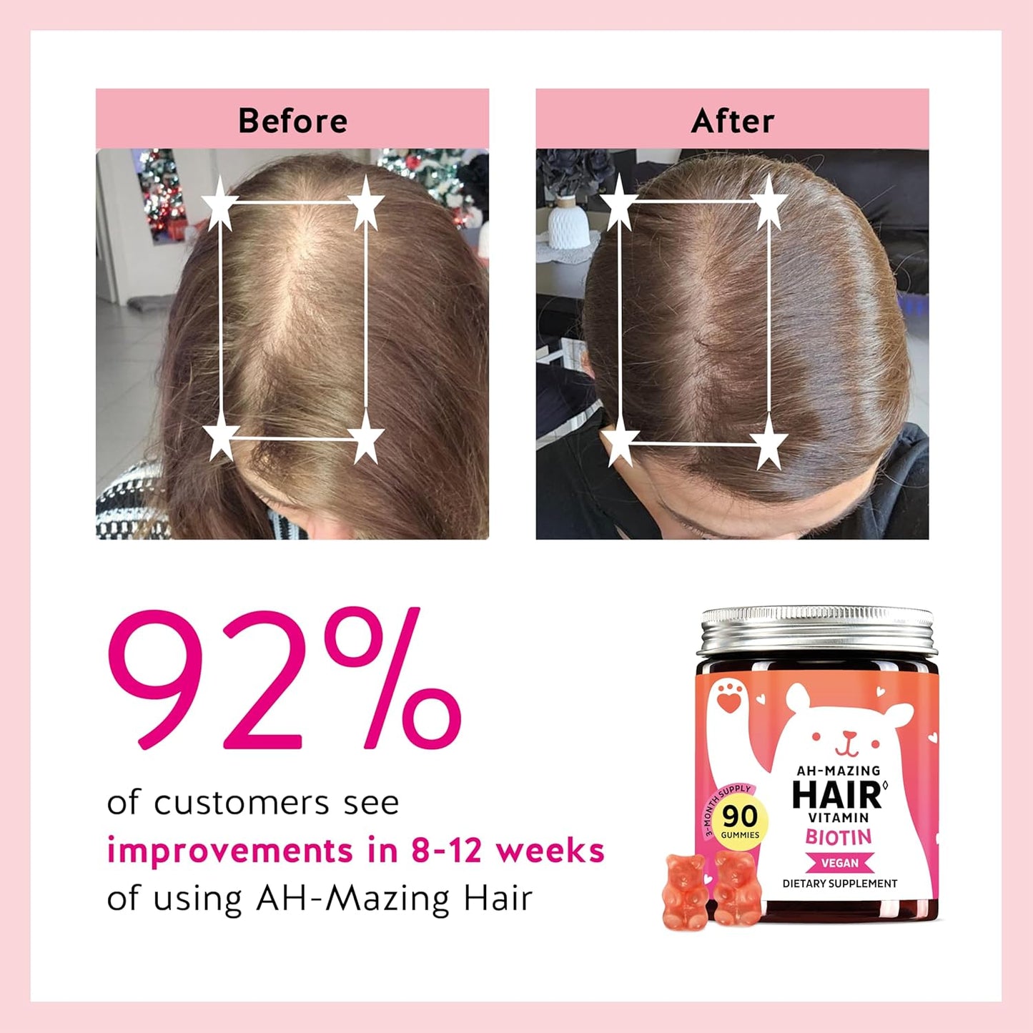 Biotin Gummies - 5000mcg Beauty Formula For Healthy Hair, Skin & Nails