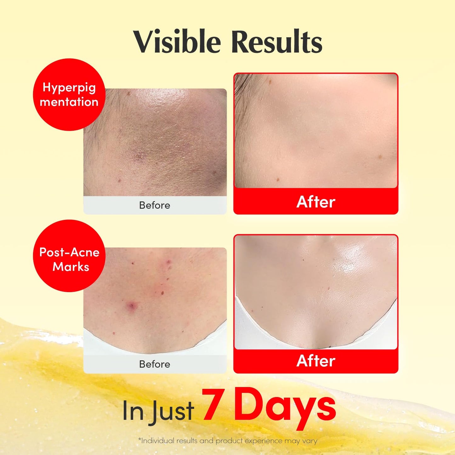 Unlock Your Ultimate Korean Glass Skin - New Packing