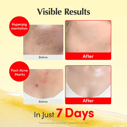 Unlock Your Ultimate Korean Glass Skin - New Packing