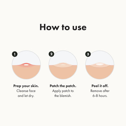 Hero Cosmetics Mighty Patch – Shrink Zits & Whiteheads in Just 1 Use(72 Count)