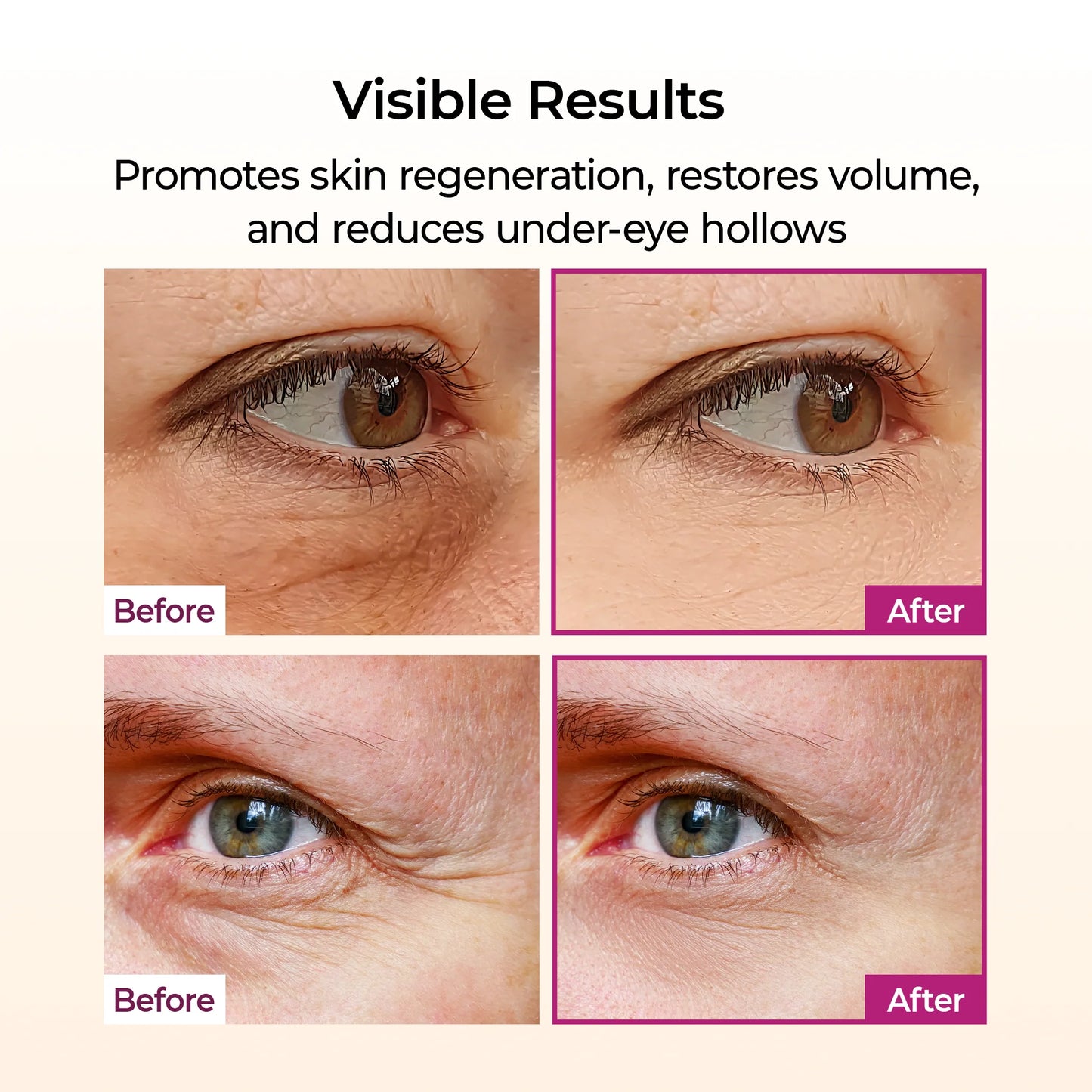 Calcium Factor: Rebuild Your Youthful Skin Matrix