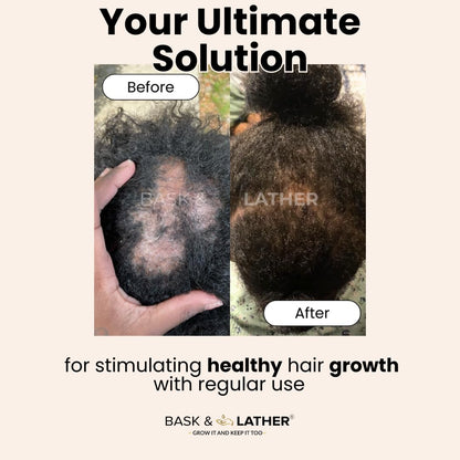 Scalp Stimulator Oil: For Thicker, Fuller Hair & Regrowth Support