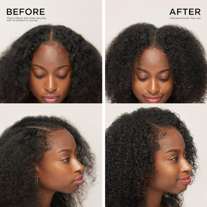 Scalp Serum - Precision Roll-On Formula For Fuller-Looking Hair