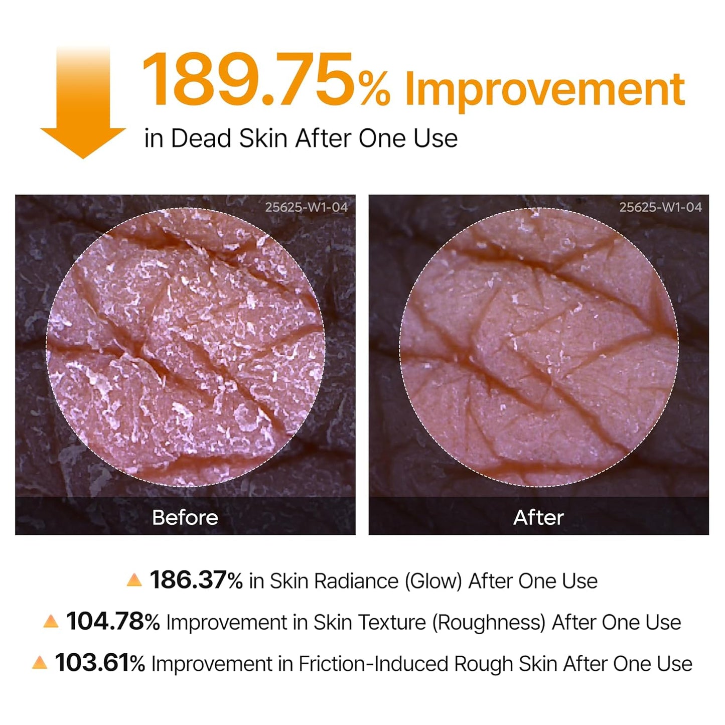 Goodbye "Strawberry Skin," Hello Radiance.