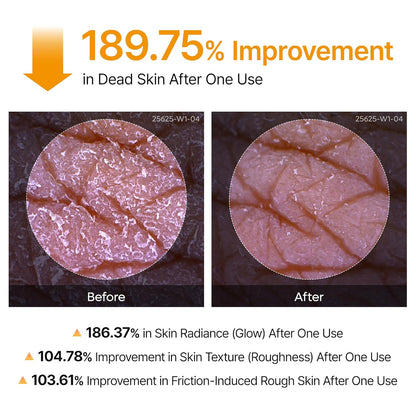 Goodbye "Strawberry Skin," Hello Radiance.