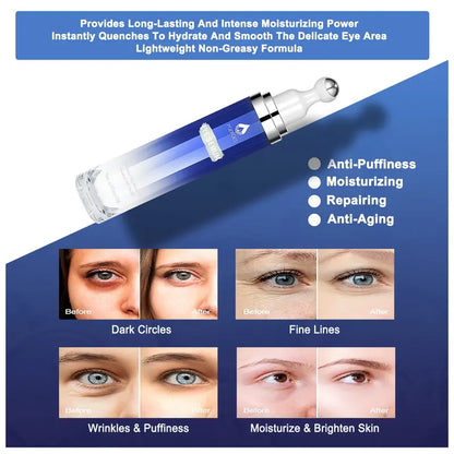 360° Cooling Roller Eye Serum - High-Strength Caffeine & Retinol Treatment for Dark Circles, Puffiness, and Wrinkles
