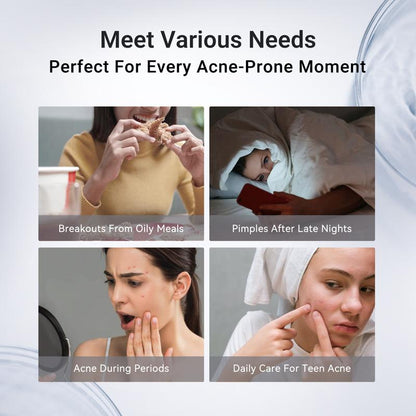 Dr. Leo 24H Pimple Emergency Lotion | Shrink Spots Overnight