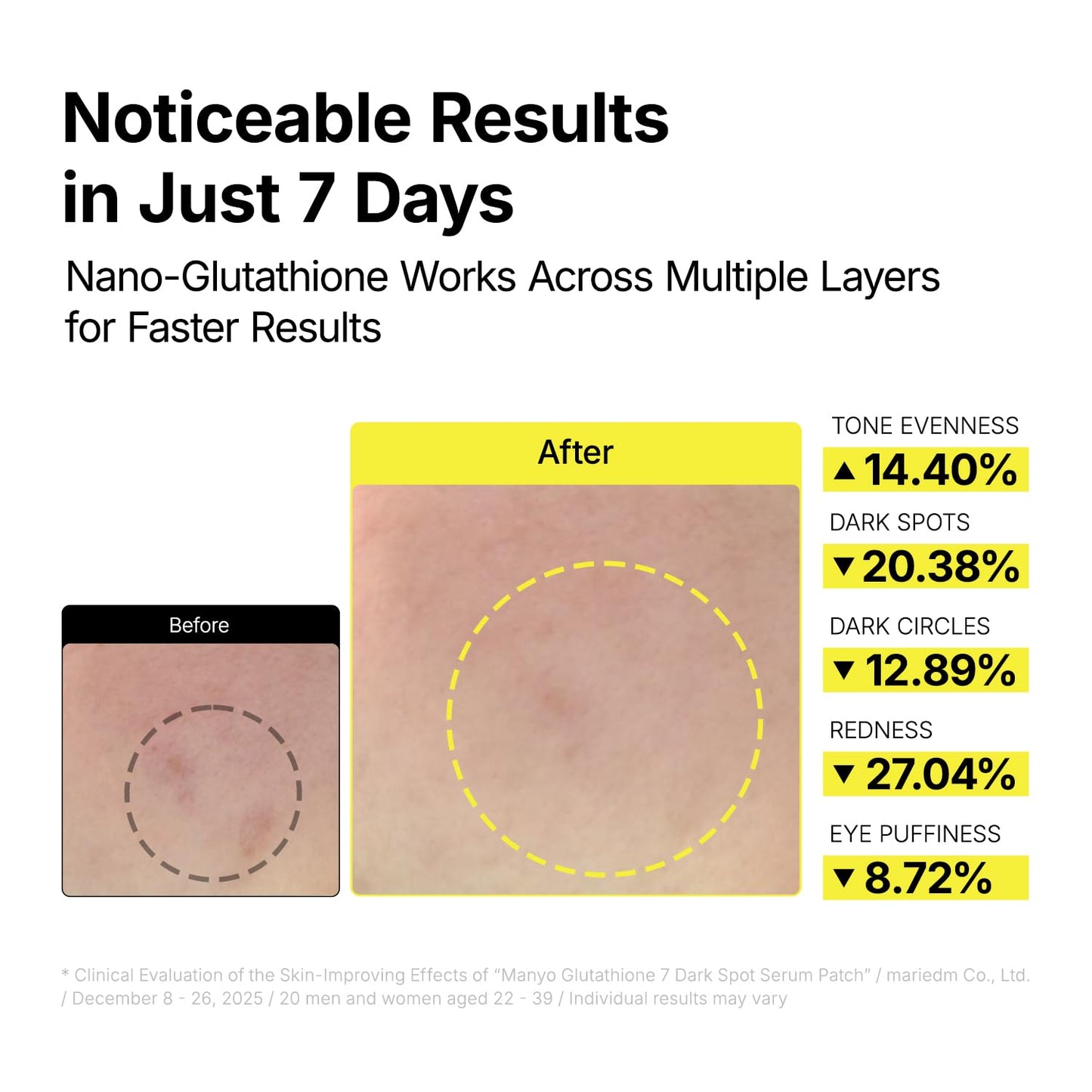Fade Dark Spots With 7 Brightening Ingredients