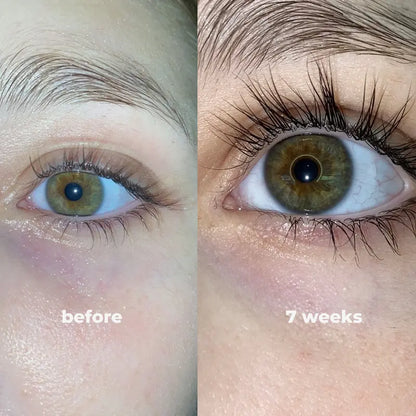 Get Visibly Longer, Thicker Lashes Naturally