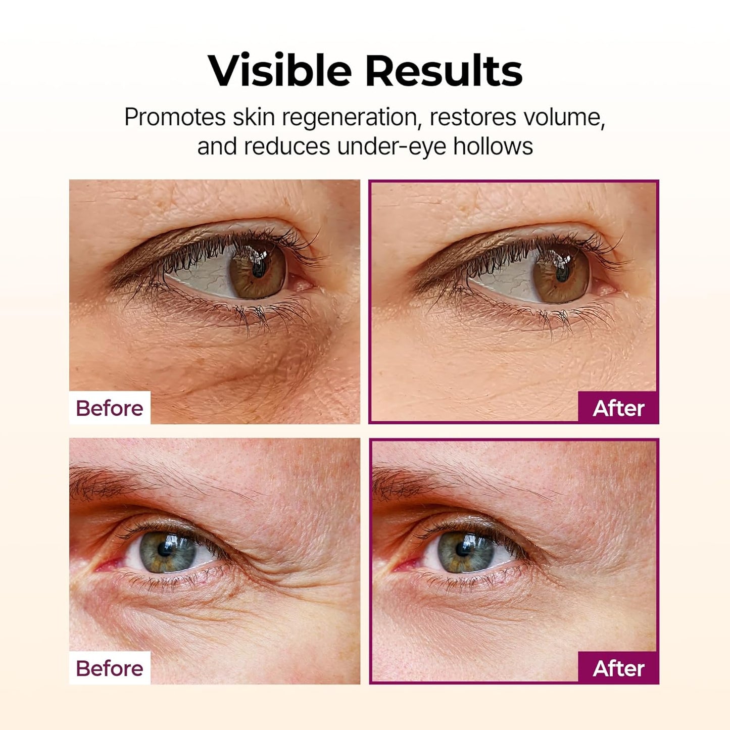 Collagen Multi Balm Stick - Erase Deep Eye Wrinkles Instantly with Calcium-Collagen Therapy