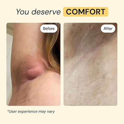 All-Purpose Skin Care Ointment: Fast-Acting Relief for Painful Bumps, Boils, and Sudden Skin Flares