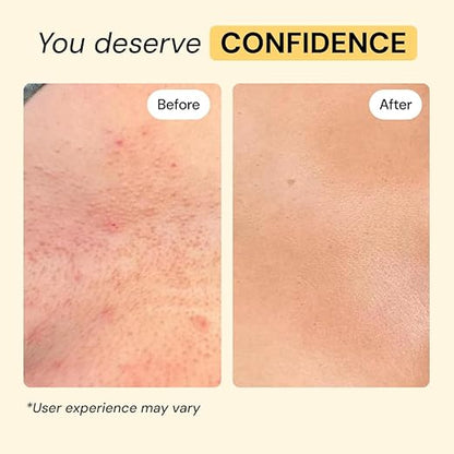 All-Purpose Skin Care Ointment: Fast-Acting Relief for Painful Bumps, Boils, and Sudden Skin Flares