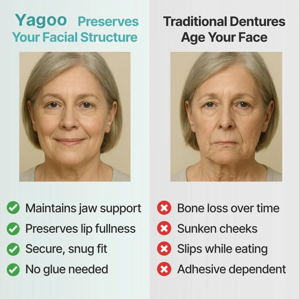 🌎Ends Today: 79% OFF! Medical Full Denture with Strong Suction
