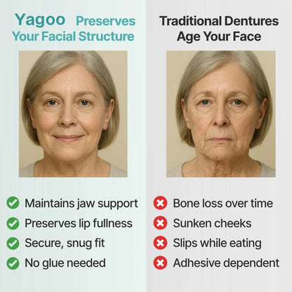 🌎Ends Today: 79% OFF! Medical Full Denture with Strong Suction