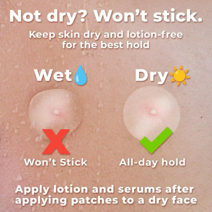 Shrink Stubborn Blemishes Overnight with Salicylic Hydrocolloid Patche