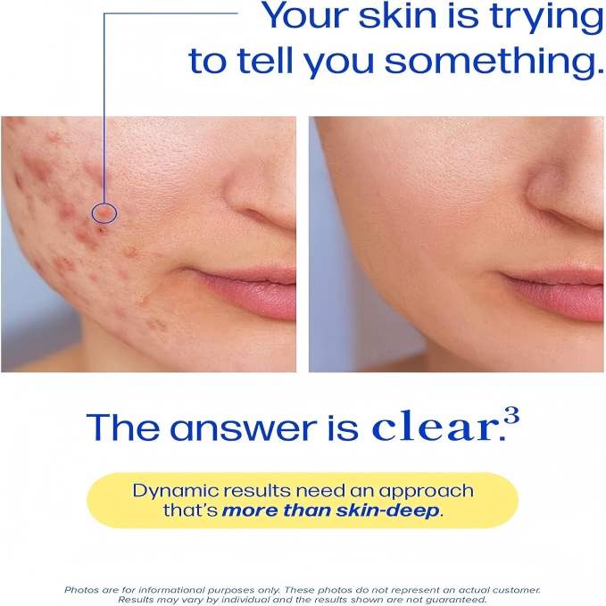 3-in-1 Triple Action Acne Complex: Clear Your Skin from Within