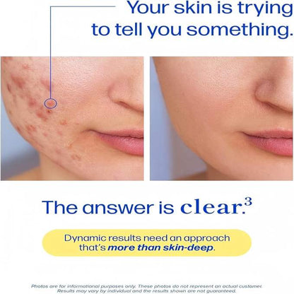 3-in-1 Triple Action Acne Complex: Clear Your Skin from Within