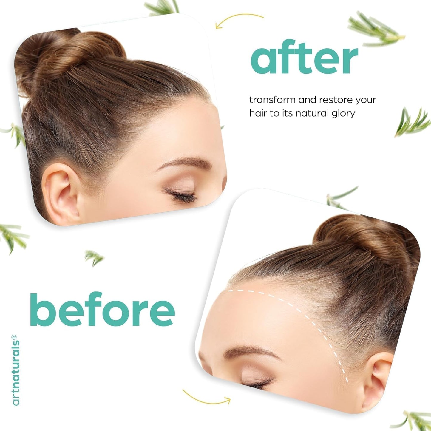 Natural Rosemary & Castor Hair Growth Elixir with Ergonomic Scalp Massager Kit